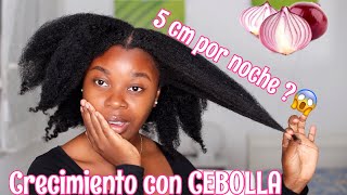 Cómo hacer CRECER el CABELLO rápido y FÁCIL con CEBOLLA  RIHANEL [upl. by Scrivenor]