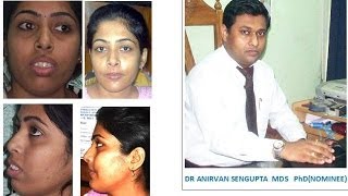 ARPITA SHEULI DASDR ANIRVAN SENGUPTAS PATIENTs INTERVIEW AFTER TREATMENT [upl. by Lamond]