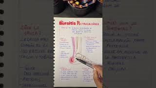 Bursitis retrocalcanea [upl. by Ailati]