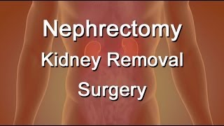 Nephrectomy  Kidney Removal Surgery [upl. by Goodman526]