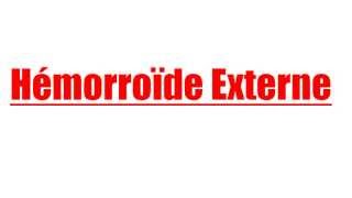 Hemoroide Externe [upl. by Onibla]