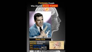 Famous People Who Died of Brain Tumor [upl. by Boar]