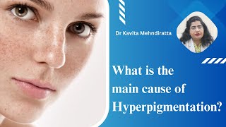 What is the main cause of Hyperpigmentation  Patient education I MIC [upl. by Trilby]