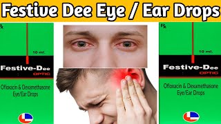 festive dee  festive dee optic eyeear drops ofloxacin dexamethasone eye ear drops [upl. by Leivad]