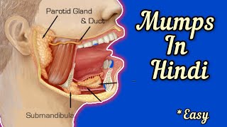 MUMPS in HINDI  Symptoms  causes  diagnosis  treatment  Vaccination  Tarang academy [upl. by Abisia]