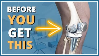 5 things you MUST know before getting a knee replacement [upl. by Boswell952]