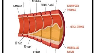 Artherosclerosis heart diseasesdisorders MSN topic ☑️🩺artherosclerosisTheaiims01 [upl. by Derk]