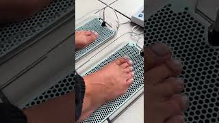 Sweaty feet No more Walk confidently with Dermadry’s antisweat device [upl. by Kaya839]