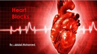 חסמי הולכה באקquotג  AV Block Types  ECG [upl. by Letniuq]