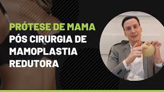 Prótese de Mama pós cirurgia de mamoplastia redutora [upl. by Wesle]