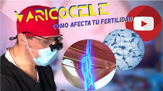 VARICOCELE COMO AFECTA TU FERTILIDAD [upl. by Tirma]