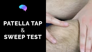 Patella Tap amp Sweep Test  OSCE Guide  Clip  UKMLA  CPSA [upl. by Yablon]