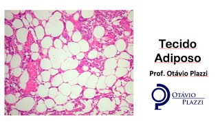 Histologia Sistêmica  Tecido Adiposo  Capítulo 6  Histologia Básica Junqueira e Carneiro [upl. by Namwen]