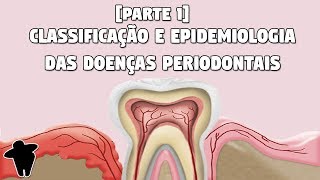 Classificação e Epidemiologia das Doenças Periodontais  Concursos Para Dentistas DE 6 PT1 [upl. by Weylin888]