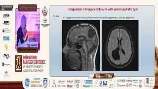 How Neuroradiologist Sees Your Profile  Imaging of Brain Lesions [upl. by Horace846]