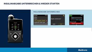 MiniMed™ 780G System – Insulinabgabe unterbrechen [upl. by Krys620]