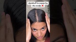 the key to perfectly healthy scalp 😳  hair growth tips youtubeshort hair hairgrowth [upl. by Areek]