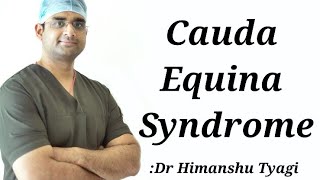 Cauda Equina Syndrome [upl. by Annemarie]