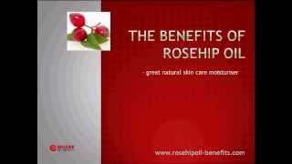 The Benefits of Rosehip Oil [upl. by Airetnuhs248]