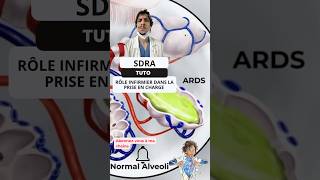 Comprendre et Prévenir le SDRA  Guide pour les Infirmiers ide tutorial nurse ards covid19 [upl. by Tsenre296]