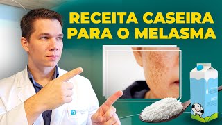 Melasma Tratamento Caseiro para uma Pele Radiante [upl. by Rosette]