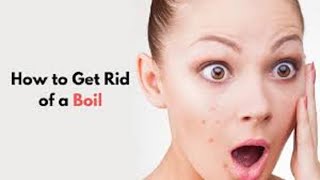 Quick Ways to Get Rid of Boils On Skin  Home remedies Health Tips  How to Treat a Boil Fast WBM [upl. by Arondell651]