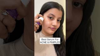 Best ANTIACNE Serum In India  Salicylic Acid  Niacinamide [upl. by Attenweiler]