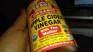 How To Pass a Kidney Stones Free and Naturally Treat Dissolve ACV health [upl. by Collier270]