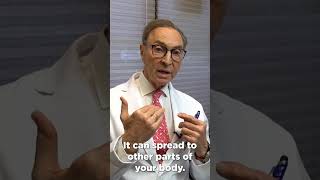 How to Treat Candida at Home Doctors Advice dentist dentalhygiene candida [upl. by Cozmo]