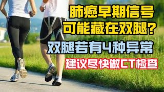 肺癌早期信號可能藏在雙腿？提醒：雙腿若有4種異常，建議儘快做CT檢查！早髮現早期治療。 [upl. by Aitnwahs]