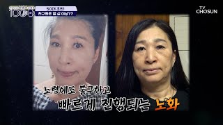 노안에 사로잡힌 삶😥 노화의 원인은 콜라겐 부족 TV CHOSUN 240309 방송  손범수와 함께 100세 더하기 1회  TV조선 [upl. by Marcello]