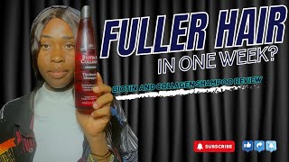 Biotin and Collagen Shampoo Review  Thicker Stronger Fuller Hair In a Week😱  XHC Product Review [upl. by Nore]