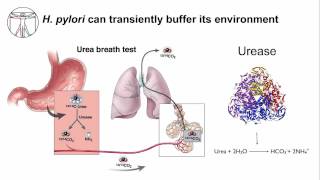 Gastritis H Pylori Persistence [upl. by Philender]