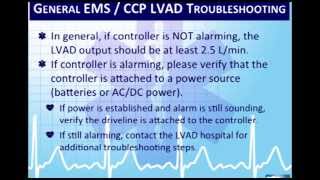 Critical Care Paramedic 7 Left Ventricular Assist Devices LVADs [upl. by Nanji]