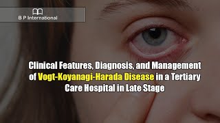 Clinical Features Diagnosis and Management of VogtKoyanagiHarada Disease in a Tertiary Care [upl. by Ecniv]