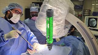 Truth About Sacroiliac Joint Fixation HarvardTrained Spine Surgeon Dr Kingsley R Chin Explains [upl. by Yann446]