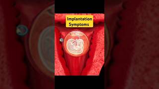 Very first Pregnancy Symptom earlypregnancy pregnancysymptomsinhindi implantation pregnancy [upl. by Letram601]