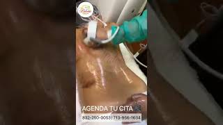 Reducción de Grasa Localizada en Espalda con Vacumterapia y Radiofrecuencia en Paloma Clinic Spa [upl. by Enniroc]