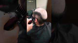 Protez Saç Merkezi SWell Hair hairreplacement protezsaç [upl. by Oflodur]