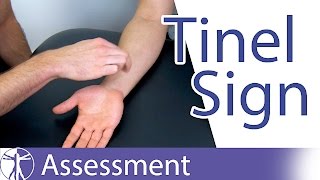 Tinel Sign Wrist  Carpal Tunnel Syndrome Diagnosis [upl. by Auqinat72]