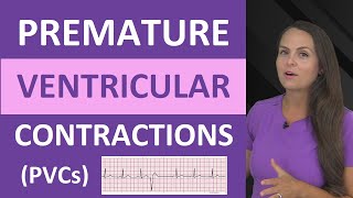 Premature Ventricular Contractions PVCs ECG Nursing NCLEX Bigeminy Trigeminy [upl. by Gonick]