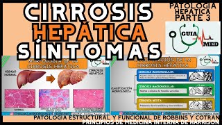 CIRROSIS HEPÁTICA SÍNTOMAS  GuiaMed [upl. by Nnairb182]