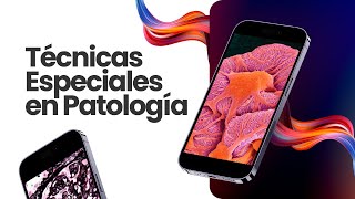 Diagnóstico en patología  Técnicas especiales [upl. by Eniloj]