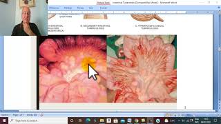 Intestinal Disorders in Arabic 5 Tabes Mesenterica   by Dr Wahdan [upl. by Dominy]