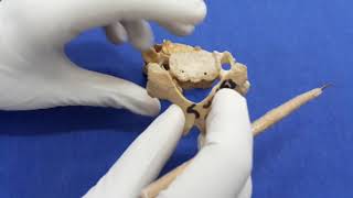 Cervical vertebraetypical and atypical osteoloy [upl. by Eilema]