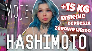 ♦️Jak żyję z HASHIMOTO♦️Moja Historia [upl. by Oigufer242]