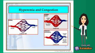 Hyperemia and Congestion  fluid and hemodynamics  pathology [upl. by Akcirahs]