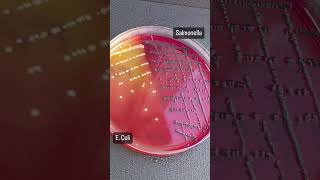 salmonella vs e coli culture [upl. by Johppah]