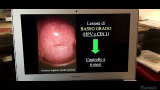 Papilloma Virus Video Liverani VP8 [upl. by Nosak]