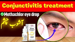 Methachlor eye drops  treatment of conjunctivitis [upl. by Compte]